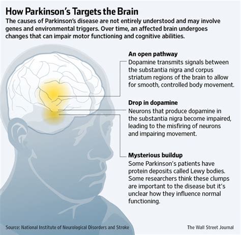 parkinson's meds side effects